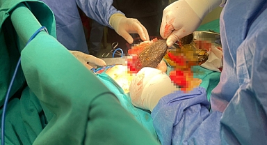 DOKTORLAR BİLE BU VAKAYA ŞOK OLDU!