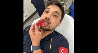 HASTA TAŞIYAN AMBULANS ŞOFÖRÜ DARP EDİLDİ!